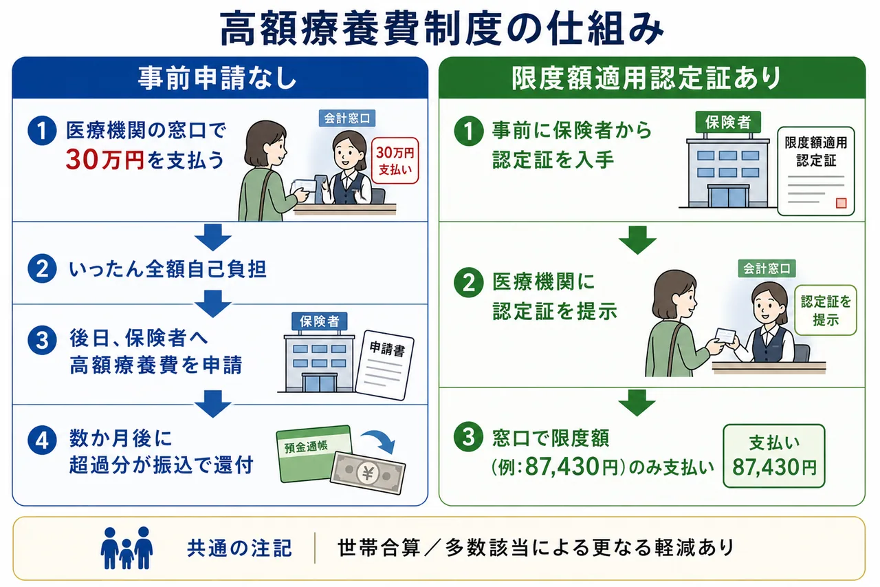 高額療養費制度の仕組み — 事前申請なし(後日還付)と限度額適用認定証ありの比較